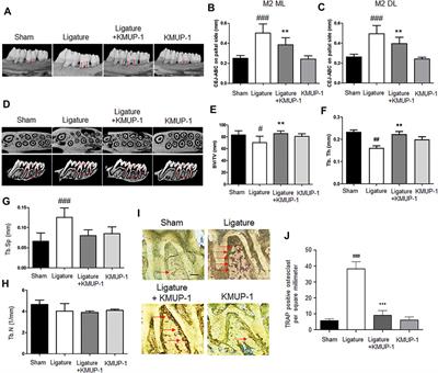 Xanthine Derivative KMUP-1 Attenuates Experimental Periodontitis by Reducing Osteoclast Differentiation and Inflammation